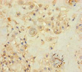 Immunohistochemistry of paraffin-embedded human placenta tissue using THAP12 Antibody at dilution of 1:100Rabbit anti-Human THAP12 Polyclonal Antibody