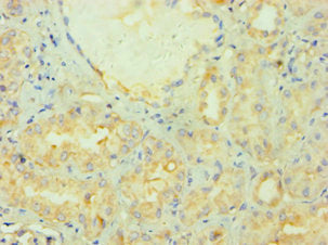 Immunohistochemistry of paraffin-embedded human kidney tissue using PRMT2 Antibody at dilution of 1:100
