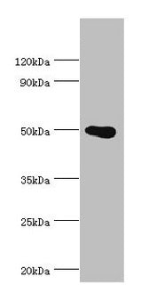 Western blot  | All lanes: PRMT2 antibody at 4µg/ml + HL60 whole cell lysate  | Secondary  | Goat polyclonal to rabbit IgG at 1/10000 dilution  | Predicted band size: 50, 32, 38, 33, 34, 26, 32 kDa  | Observed band size: 50 kDa