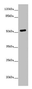 Western blot | All lanes: PRMT3 antibody at 7μg/ml + MCF-7 whole cell lysate | Secondary | Goat polyclonal to rabbit IgG at 1/10000 dilution | Predicted band size: 60, 53 kDa | Observed band size: 53 kDaRabbit anti-Human PRMT3 Polyclonal Antibody
