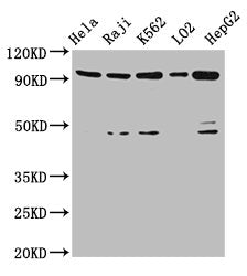 Western Blot | Positive WB detected in: Hela whole cell lysate, Raji whole cell lysate, K562 whole cell lysate, LO2 whole cell lysate, HepG2 whole cell lysate | All lanes: PROM1 antibody at 4.8μg/ml | Secondary | Goat polyclonal to rabbit IgG at 1/50000 dilution | Predicted band size: 98, 97, 94, 93, 95 kDa | Observed band size: 98 kDaRabbit anti-Human PROM1 Polyclonal Antibody