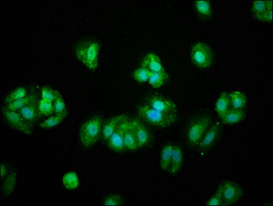 Immunofluorescence staining of HepG2 cells with PROS1 Antibody at 1:66, counter-stained with DAPI. The cells were fixed in 4% formaldehyde, permeabilized using 0.2% Triton X-100 and blocked in 10% normal Goat Serum. The cells were then incubated with the antibody overnight at 4°C. The secondary antibody was Alexa Fluor 488-congugated AffiniPure Goat Anti-Rabbit IgG(H+L).Rabbit anti-Human PROS1 Polyclonal Antibody