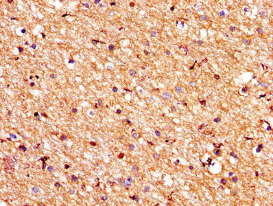 IHC image of PROS1 Antibody diluted at 1:200 and staining in paraffin-embedded human brain tissue performed on a Leica BondTM system. After dewaxing and hydration, antigen retrieval was mediated by high pressure in a citrate buffer (pH 6.0). Section was blocked with 10% normal goat serum 30min at RT. Then primary antibody (1% BSA) was incubated at 4°C overnight. The primary is detected by a biotinylated secondary antibody and visualized using an HRP conjugated SP system.Rabbit anti-Human PROS1 Polyclonal Antibody