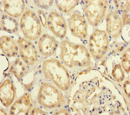 Immunohistochemistry of paraffin-embedded human kidney tissue using PRPF4 Antibody at dilution of 1:100Rabbit anti-Human PRPF4 Polyclonal Antibody