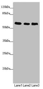 Western blot  | All lanes: PRPF4 antibody at 2.87µg/ml  | Lane 1: Jurkat whole cell lysate  | Lane 2: Hela whole cell lysate  | Lane 3: HepG2 whole cell lysate  | Secondary  | Goat polyclonal to rabbit IgG at 1/10000 dilution  | Predicted band size: 59 kDa  | Observed band size: 59 kDaRabbit anti-Human PRPF4 Polyclonal Antibody