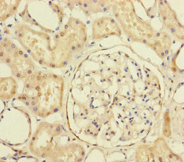 Immunohistochemistry of paraffin-embedded human kidney tissue using PRPF4 Antibody at dilution of 1:100Rabbit anti-Human PRPF4 Polyclonal Antibody