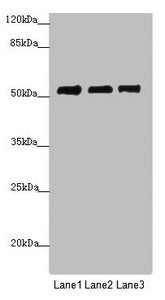 Western blot | All lanes: PRPF4 antibody at 3.89 μg/ml | Lane 1: Jurkat whole cell lysate | Lane 2: Hela whole cell lysate | Lane 3: HepG2 whole cell lysate | Secondary | Goat polyclonal to rabbit IgG at 1/10000 dilution | Predicted band size: 58 kDa | Observed band size: 58 kDaRabbit anti-Human PRPF4 Polyclonal Antibody