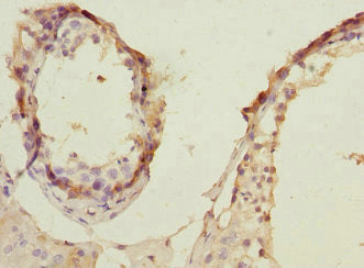 Immunohistochemistry of paraffin-embedded human testis tissue using PRPS1 Antibody at dilution of 1:100Rabbit anti-Human PRPS1 Polyclonal Antibody