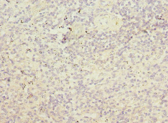 Immunohistochemistry of paraffin-embedded human spleen tissue using PRPS1 Antibody at dilution of 1:100Rabbit anti-Human PRPS1 Polyclonal Antibody