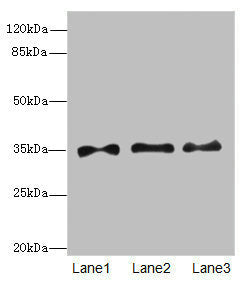 Western blot | All lanes: PRPS1antibody at 6.28μg/ml | Lane 1: HepG2 whole cell lysate | Lane 2: Jurkat whole cell lysate | Lane 3: 293T whole cell lysate | Secondary | Goat polyclonal to rabbit IgG at 1/10000 dilution | Predicted band size: 35, 28 kDa | Observed band size: 35 kDaRabbit anti-Human PRPS1 Polyclonal Antibody