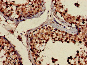 Immunohistochemistry of paraffin-embedded human testis tissue using PRPS2 Antibody at dilution of 1:100Rabbit anti-Human PRPS2 Polyclonal Antibody