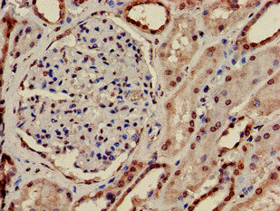 Immunohistochemistry of paraffin-embedded human kidney tissue using PRPS2 Antibody at dilution of 1:100Rabbit anti-Human PRPS2 Polyclonal Antibody