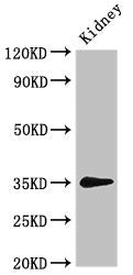 Western Blot | Positive WB detected in: Rat kidney tissue | All lanes: PRPS2 antibody at 3μg/ml | Secondary | Goat polyclonal to rabbit IgG at 1/50000 dilution | Predicted band size: 35, 36 kDa | Observed band size: 35 kDaRabbit anti-Human PRPS2 Polyclonal Antibody