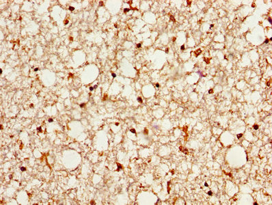 IHC image of PSAP Antibody diluted at 1:500 and staining in paraffin-embedded human brain tissue performed on a Leica BondTM system. After dewaxing and hydration, antigen retrieval was mediated by high pressure in a citrate buffer (pH 6.0). Section was blocked with 10% normal goat serum 30min at RT. Then primary antibody (1% BSA) was incubated at 4°C overnight. The primary is detected by a biotinylated secondary antibody and visualized using an HRP conjugated SP system.Rabbit anti-Human PSAP Polyclonal Antibody