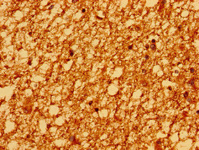 Immunohistochemistry of paraffin-embedded human brain tissue using PSD Antibody at dilution of 1:100Rabbit anti-Human PSD Polyclonal Antibody