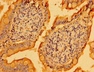 Immunohistochemistry of paraffin-embedded human small intestine tissue using PSD Antibody at dilution of 1:100Rabbit anti-Human PSD Polyclonal Antibody
