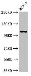 Western Blot  | Positive WB detected in: MCF-7 whole cell lysate  | All lanes: PSD antibody at 3.2µg/ml  | Secondary  | Goat polyclonal to rabbit IgG at 1/50000 dilution  | Predicted band size: 110, 71 kDa  | Observed band size: 110 kDaRabbit anti-Human PSD Polyclonal Antibody