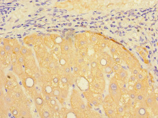 Immunohistochemistry of paraffin-embedded human liver tissue using PSEN1 Antibody at dilution of 1:100Rabbit anti-Human PSEN1 Polyclonal Antibody