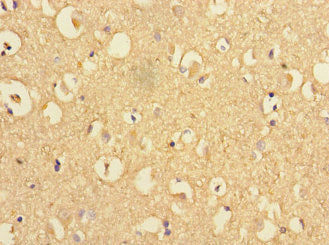 Immunohistochemistry of paraffin-embedded human brain tissue using PSEN1 Antibody at dilution of 1:100Rabbit anti-Human PSEN1 Polyclonal Antibody