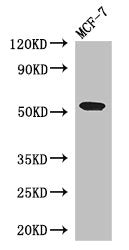 Western Blot | Positive WB detected in: MCF-7 whole cell lysate | All lanes: PSEN1 antibody at 3μg/ml | Secondary | Goat polyclonal to rabbit IgG at 1/50000 dilution | Predicted band size: 53, 43, 22, 47, 49 kDa | Observed band size: 53 kDaRabbit anti-Human PSEN1 Polyclonal Antibody