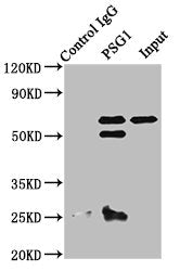 Immunoprecipitating PSG1 in A549 whole cell lysate  | Lane 1: Rabbit control IgG instead of PSG1 Antibody in A549 whole cell lysate. For western blotting, a HRP-conjµgated Protein G antibody was used as the secondary antibody (1/2000)  | Lane 2: PSG1 Antibody (8µg) + A549 whole cell lysate (500µg)  | Lane 3: A549 whole cell lysate (10µg)