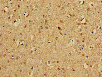 Immunohistochemistry of paraffin-embedded human brain tissue using PSMA3 Antibody at dilution of 1:100Rabbit anti-Human PSMA3 Polyclonal Antibody