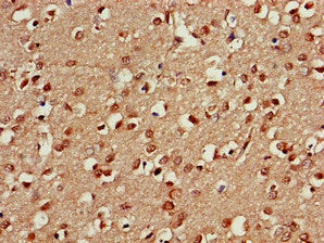 Immunohistochemistry of paraffin-embedded human brain tissue using PSMA5 Antibody at dilution of 1:100Rabbit anti-Human PSMA5 Polyclonal Antibody