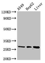 Western Blot | Positive WB detected in: A549 whole cell lysate, HepG2 whole cell lysate, Rat liver tissue | All lanes: PSMA5 antibody at 3μg/ml | Secondary | Goat polyclonal to rabbit IgG at 1/50000 dilution | Predicted band size: 27, 21 kDa | Observed band size: 27 kDaRabbit anti-Human PSMA5 Polyclonal Antibody