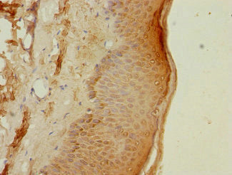 Immunohistochemistry of paraffin-embedded human skin tissue using PSMB3 Antibody at dilution of 1:100Rabbit anti-Human PSMB3 Polyclonal Antibody