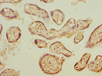 Immunohistochemistry of paraffin-embedded human placenta tissue using PSMB3 Antibody at dilution of 1:100Rabbit anti-Human PSMB3 Polyclonal Antibody