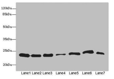 Western blot  | All lanes: PSMB3 antibody at 3.73µg/ml  | Lane 1: Hela whole cell lysate  | Lane 2: MCF-7 whole cell lysate  | Lane 3: HepG2 whole cell lysate  | Lane 4: K562 whole cell lysate  | Lane 5: Jurkat whole cell lysate  | Lane 6: NIH/3T3 whole cell lysate  | Lane 7: 293T whole cell lysate  | Secondary  | Goat polyclonal to rabbit IgG at 1/10000 dilution  | Predicted band size: 23 kDa  | Observed band size: 23 kDaRabbit anti-Human PSMB3 Polyclonal Antibody