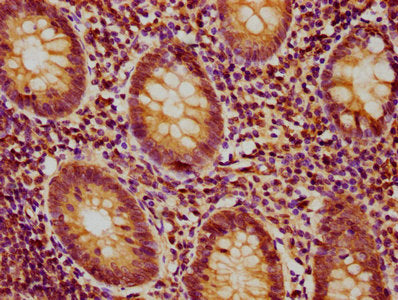 IHC image of PSMB9 Antibody diluted at 1:400 and staining in paraffin-embedded human appendix tissue performed on a Leica BondTM system. After dewaxing and hydration, antigen retrieval was mediated by high pressure in a citrate buffer (pH 6.0). Section was blocked with 10% normal goat serum 30min at RT. Then primary antibody (1% BSA) was incubated at 4°C overnight. The primary is detected by a biotinylated secondary antibody and visualized using an HRP conjugated SP system.Rabbit anti-Human PSMB9 Polyclonal Antibody