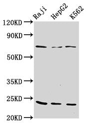Western Blot  | Positive WB detected in: Raji whole cell lysate, HepG2 whole cell lysate, K562 whole cell lysate  | All lanes: PSMB9 antibody at 10µg/ml  | Secondary  | Goat polyclonal to rabbit IgG at 1/50000 dilution  | Predicted band size: 24, 23  kDa  | Observed band size: 24 kDaRabbit anti-Human PSMB9 Polyclonal Antibody