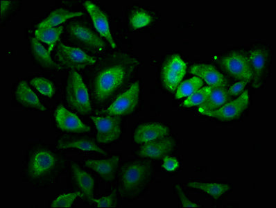 Immunofluorescence staining of A549 cells with PSMC3 Antibody at 1:530, counter-stained with DAPI. The cells were fixed in 4% formaldehyde, permeabilized using 0.2% Triton X-100 and blocked in 10% normal Goat Serum. The cells were then incubated with the antibody overnight at 4°C. The secondary antibody was Alexa Fluor 488-congugated AffiniPure Goat Anti-Rabbit IgG(H+L).Rabbit anti-Human PSMC3 Polyclonal Antibody