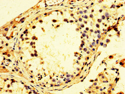Immunohistochemistry of paraffin-embedded human testis tissue using PSMC3 Antibody at dilution of 1:100Rabbit anti-Human PSMC3 Polyclonal Antibody