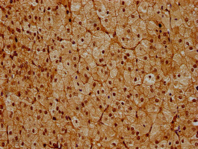 IHC image of PSMC6 Antibody diluted at 1:600 and staining in paraffin-embedded human adrenal gland tissue performed on a Leica BondTM system. After dewaxing and hydration, antigen retrieval was mediated by high pressure in a citrate buffer (pH 6.0). Section was blocked with 10% normal goat serum 30min at RT. Then primary antibody (1% BSA) was incubated at 4°C overnight. The primary is detected by a biotinylated secondary antibody and visualized using an HRP conjugated SP system.Rabbit anti-Human PSMC6 Polyclonal Antibody