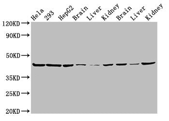 Western Blot  | Positive WB detected in: Hela whole cell lysate, 293 whole cell lysate, HepG2 whole cell lysate, Mouse brain tissue, Mouse liver tissue, Mouse kidney tissue, Rat brain tissue, Rat liver tissue, Rat kidney tissue  | All lanes: PSMC6 antibody at 3µg/ml  | Secondary  | Goat polyclonal to rabbit IgG at 1/50000 dilution  | Predicted band size: 45 kDa  | Observed band size: 45 kDaRabbit anti-Human PSMC6 Polyclonal Antibody