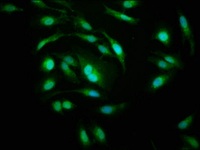 Immunofluorescence staining of Hela cells with PSMD10 Antibody at 1:200, counter-stained with DAPI. The cells were fixed in 4% formaldehyde, permeabilized using 0.2% Triton X-100 and blocked in 10% normal Goat Serum. The cells were then incubated with the antibody overnight at 4°C. The secondary antibody was Alexa Fluor 488-congugated AffiniPure Goat Anti-Rabbit IgG(H+L).Rabbit anti-Human PSMD10 Polyclonal Antibody