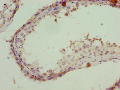 Immunohistochemistry of paraffin-embedded human testis tissue using the antibody at dilution of 1:100Rabbit anti-Human PSMD10 Polyclonal Antibody