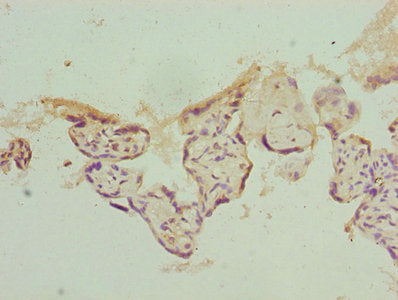 Immunohistochemistry of paraffin-embedded human placenta tissue using PSMD10 Antibody at dilution of 1:100Rabbit anti-Human PSMD10 Polyclonal Antibody