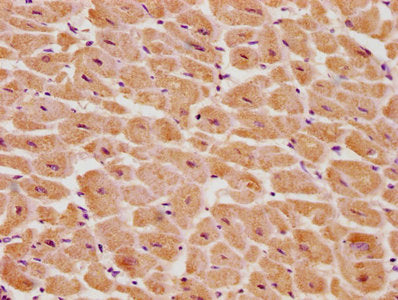 IHC image of PSMD14 Antibody diluted at 1:100 and staining in paraffin-embedded human heart tissue performed on a Leica BondTM system. After dewaxing and hydration, antigen retrieval was mediated by high pressure in a citrate buffer (pH 6.0). Section was blocked with 10% normal goat serum 30min at RT. Then primary antibody (1% BSA) was incubated at 4°C overnight. The primary is detected by a biotinylated secondary antibody and visualized using an HRP conjugated SP system.Rabbit anti-Human PSMD14 Polyclonal Antibody