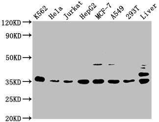 Western Blot  | Positive WB detected in: K562 whole cell lysate, Hela whole cell lysate, Jurkat whole cell lysate, HepG2 whole cell lysate, MCF-7 whole cell lysate, A549 whole cell lysate, 293T whole cell lysate, Rat liver tissue  | All lanes: PSMD14 antibody at 1:2000  | Secondary  | Goat polyclonal to rabbit IgG at 1/50000 dilution  | Predicted band size: 35 kDa  | Observed band size: 35 kDaRabbit anti-Human PSMD14 Polyclonal Antibody