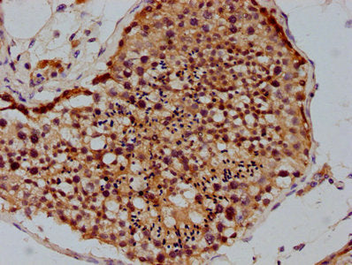 IHC image of PSMD4 Antibody diluted at 1:100 and staining in paraffin-embedded human testis tissue performed on a Leica BondTM system. After dewaxing and hydration, antigen retrieval was mediated by high pressure in a citrate buffer (pH 6.0). Section was blocked with 10% normal goat serum 30min at RT. Then primary antibody (1% BSA) was incubated at 4°C overnight. The primary is detected by a biotinylated secondary antibody and visualized using an HRP conjugated SP system.Rabbit anti-Human PSMD4 Polyclonal Antibody