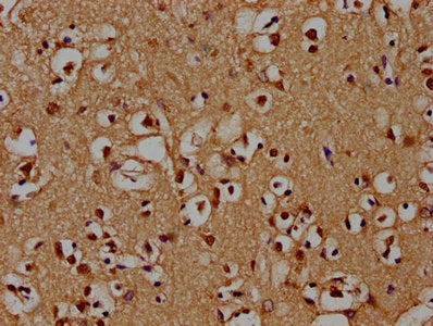 IHC image of PSMD4 Antibody diluted at 1:100 and staining in paraffin-embedded human brain tissue performed on a Leica BondTM system. After dewaxing and hydration, antigen retrieval was mediated by high pressure in a citrate buffer (pH 6.0). Section was blocked with 10% normal goat serum 30min at RT. Then primary antibody (1% BSA) was incubated at 4°C overnight. The primary is detected by a biotinylated secondary antibody and visualized using an HRP conjugated SP system.Rabbit anti-Human PSMD4 Polyclonal Antibody