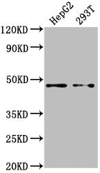 Western Blot | Positive WB detected in: HepG2 whole cell lysate, 293T whole cell lysate | All lanes: PSMD4 antibody at 1:2000 | Secondary | Goat polyclonal to rabbit IgG at 1/50000 dilution | Predicted band size: 41, 29 kDa | Observed band size: 41 kDaRabbit anti-Human PSMD4 Polyclonal Antibody