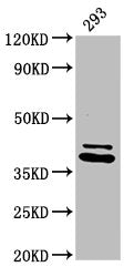 Western Blot | Positive WB detected in: 293 whole cell lysate | All lanes: PSMD7 antibody at 3.2μg/ml | Secondary | Goat polyclonal to rabbit IgG at 1/50000 dilution | Predicted band size: 38 kDa | Observed band size: 38 kDa