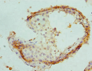 Immunohistochemistry of paraffin-embedded human testis tissue using PSME1 Antibody at dilution of 1:100Rabbit anti-Human PSME1 Polyclonal Antibody
