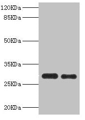 Western blot  | All lanes: PSME1 antibody at 0.75µg/ml  | Lane 1: Mouse liver tissue  | Lane 2: Raji whole cell lysate  | Secondary  | Goat polyclonal to rabbit IgG at 1/10000 dilution  | Predicted band size: 29, 27 kDa  | Observed band size: 29 kDaRabbit anti-Human PSME1 Polyclonal Antibody