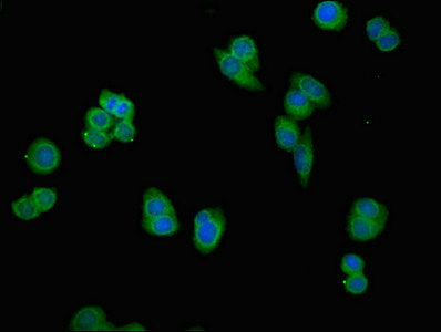 Immunofluorescent analysis of PC-3 cells using PSMG1 Antibody at dilution of 1:100 and Alexa Fluor 488-congugated AffiniPure Goat Anti-Rabbit IgG(H+L)Rabbit anti-Human PSMG1 Polyclonal Antibody