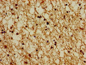 Immunohistochemistry of paraffin-embedded human brain tissue using PSMG1 Antibody at dilution of 1:100Rabbit anti-Human PSMG1 Polyclonal Antibody